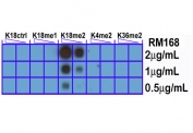 A peptide dot blot shows the recombinant H3K18me2 antibody only reacts to Histone H3 dimethyl-Lysine 18 (K18me2). No cross reactivity with unmodified (K18Ctrl) or monomethylated Lysine 18 (K18me1), dimethylated Lysine 4 (K4me2) or dimethylated Lysine 36 (K36me2).