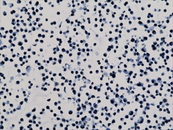 ICC staining of human HepG2 cells with recombinant H3K79me2 antibody.