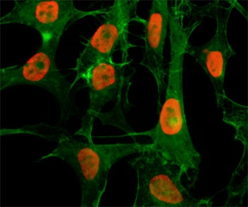 ICC/IF staining of HeLa cells treated with sodium butyrate using recombinant H3K56ac antibody (red). Actin filaments have been labeled with fluorescein phalloidin (green).
