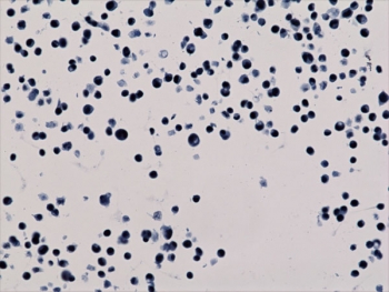 ICC staining of human HepG2 cells with recombinant H3K56ac antibody.