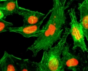 ICC/IF staining of HeLa cells treated with sodium butyrate using recombinant H4R3me1 antibody (red). Actin filaments have been labeled with fluorescein phalloidin (green).