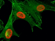 ICC/IF staining of HeLa cells treated with sodium butyrate using recombinant H4K5ac antibody (red). Actin filaments have been labeled with fluorescein phalloidin (green).