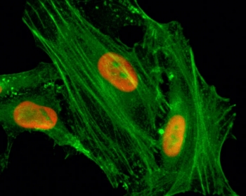 ICC/IF staining of HeLa cells treated with sodium butyrate using recombinant H4K8ac antibody (red). Actin filaments have been labeled with fluorescein phalloidin (green).