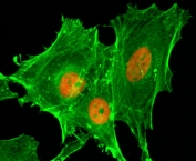 ICC/IF staining of HeLa cells treated with sodium butyrate using recombinant H4K20ac antibody (red). Actin filaments have been labeled with fluorescein phalloidin (green).