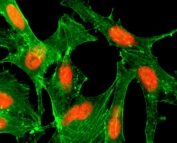 ICC/IF staining of HeLa cells treated with sodium butyrate using recombinant H4K12ac antibody (red). Actin filaments have been labeled with fluorescein phalloidin (green).