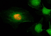 ICC/IF staining of HeLa cells using recombinant phospho-Histone H2A/H4 antibody (red). Actin filaments have been labeled with fluorescein phalloidin (green).