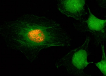 ICC/IF staining of HeLa cells using recombinant phospho-Histone H2A/H4 antibody (red). Actin filaments have been labeled with fluorescein phalloidin (green).