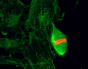 ICC/IF of HeLa cells using recombinant phospho-Histone H3 antibody (red). Actin filaments have been labeled with fluorescein phalloidin (green).