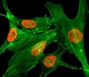 ICC/IF staining of HeLa cells treated with sodium butyrate using recombinant H2A.ZK4ac antibody (red). Actin filaments have been labeled with fluorescein phalloidin (green).