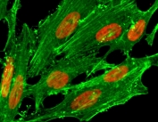 ICC/IF staining of HeLa cells treated with sodium butyrate using recombinant H2A.ZK7ac antibody (red). Actin filaments have been labeled with fluorescein phalloidin (green).