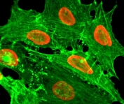 ICC/IF staining of HeLa cells treated with sodium butyrate using recombinant H2BK20ac antibody (red). Actin filaments have been labeled with fluorescein phalloidin (green).