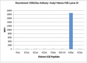 This recombinant H2BK20ac antibody specifically reacts to Histone H2B acetylated at Lysine 20 (K20ac). No cross reactivity with non-modified Lysine 20 or other acetylated Lysines in Histone H2B.