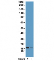 Western blot test of acid extracts from HeLa cells treated (+) or untreated (-) with sodium butyrate, using recombinant H2BK20ac antibody at 0.5 ug/ml.