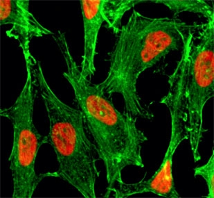 ICC/IF of HeLa cells treated with sodium butyrate, using recombinant H2BK23ac antibody (red). Actin filaments have been labeled with fluorescein phalloidin (green).
