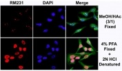 ICC/IF staining of HeLa cells recombinant 5mC antibody (red). Actin filaments have been labeled with fluorescein phalloidin (green), and nuclei stained with DAPI (blue).