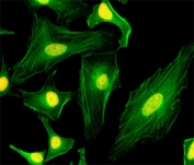 ICC/IF of HeLa cells using recombinant MacroH2A.1 antibody (red). Actin filaments have been labeled with fluorescein phalloidin (green).