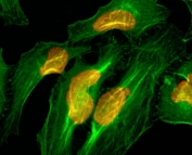 ICC/IF of HeLa cells using recombinant Histone H2A antibody (red). Actin filaments have been labeled with fluorescein phalloidin (green).