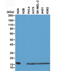 Western blot of recombinant Histone H2A protein, H2B protein and whole cell lysates of human HeLa, A375, SK-MEL-2, A431, and K562 cells using recombinant Histone H2A antibody at 0.5 ug/ml. Predicted molecular weight ~14 kDa.~