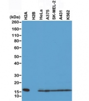 Western blot of recombinant Histone H2A protein, H2B protein and whole cell lysates of human HeLa, A375, SK-MEL-2, A431, and K562 cells using recombinant Histone H2A antibody at 0.5 ug/ml. Predicted molecular weight ~14 kDa.