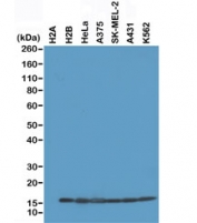 Western blot of recombinant Histone H2A protein, H2B protein and whole cell lysates of human HeLa, A375, SK-MEL-2, A431, and K562 cells using recombinant Histone H2B antibody at 0.2 ug/ml.