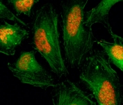 ICC/IF staining of human HeLa cells using recombinant Histone H2AX antibody (red). Actin filaments have been labeled with fluorescein phalloidin (green).