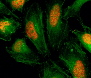 ICC/IF staining of human HeLa cells using recombinant Histone H2AX antibody (