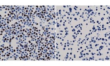 ICC staining of 293T cells expressing His-Tag nuclear protein X (left) and negative control HepG2 cells (right) using the recombinant His Tag antibody.