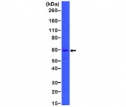 Western blot of A431 cell lysate with recombinant CK5 antibody. Predicted molecular weight 58~62 kDa.
