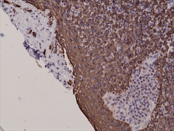 IHC staining of FFPE human tonsil tissue with recombinant CK5 antibody.