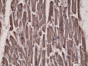 IHC testing of FFPE human heart tissue with recombinant ACC antibody.