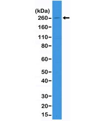 Western blot of A431 cell lysate using recombinant ACC antibody at 1:1000. Observed molecular weight ~260 kDa.~