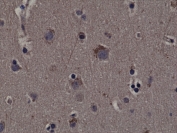 IHC testing of FFPE human cerebral cortex tissue with recombinant phospho-RSK1 antibody.