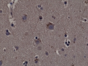 IHC testing of FFPE human cerebral cortex tissue with recombinant phospho-RSK1 antibody.