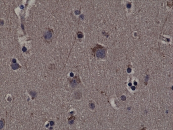 IHC testing of FFPE human cerebral cortex tissue with recombinant phospho-RSK1