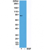 Western blot of A431 cells treated (+) or untreated (-) with EGF, using recombinant phospho-RSK1 antibody at 1:1000. Predicted molecular weight: 83-90 kDa.