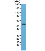 Western blot testing of mouse heart lysate with recombinant Desmin antibody. Predicted molecular weight ~54 kDa.