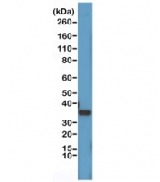 Western blot testing of human HeLa cell lysate with recombinant Cyclin D1 antibody at 1:1000. Predicted molecular weight: 32-36 kDa.