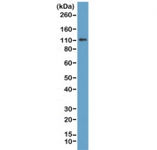 Western blot of human MCF7 lysate using recombinant E-Cadherin antibody at 1:1000. Expected molecular weight: 135 kDa (precursor), 80-120 kDa (mature, depending on gylcosylation level).