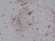 IHC testing of FFPE human brain tissue with recombinant GFAP antibody at 1:500.