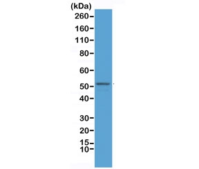 Western blot testing of mouse brain lysate with recombinant GFAP antibody at 1:2500. Predicted molecular weight ~50 kDa.~