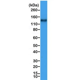 Western blot testing of human Jurkat cell lysate with recombinant CD31 antibody at 1:1000. Expected molecular weight: 83-130 kDa depending on level of glycosylation.~