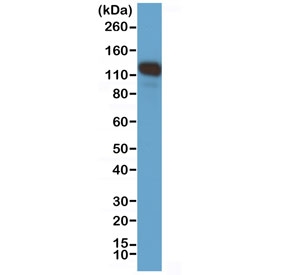 Western blot testing of human A375 cell lysate with recombinant CD146 antibody at 1:1000. Observed molecular weight 70-120 kDa depending on glycosylation level.~