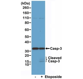 Western blot of Jurkat cell lysate, untreated or treated with Etoposide, using recombinant Caspase-3 antibody at 1:1000.~