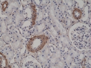 IHC testing of FFPE human kidney tissue with recombinant ACTA2 antibody at 1:2500. 