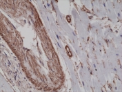 IHC testing of FFPE human heart tissue with recombinant ACTA2 antibody at 1:2500. 