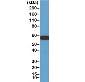 Western blot testing of 293 cell lysate with recombinant AKT1 antibody at 1:1000. Predicted molecular weight ~56 kDa.~