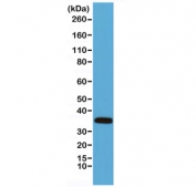 Western blot testing of mouse heart lysate with recombinant Calponin antibody. Predicted molecular weight ~33 kDa.