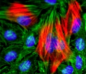 ICC/IF of human HeLa cells using recombinant Calponin antibody (red). Actin filaments have been labeled with fluorescein phalloidin (green), and nucleus stained with DAPI (blue).