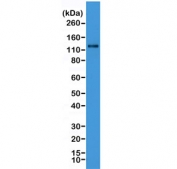 Western blot testing of human HeLa cell lysate with recombinant N-Cadherin antibody. Predicted molecular weight ~100 kDa (unmodified), 125-140 kDa (modified).
