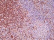 IHC testing of FFPE human tonsil tissue with recombinant Paxillin antibody. HIER: steam section in pH6 citrate buffer for 20 min and allow to cool prior to staining.